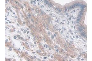 DAB staining on IHC-P; Samples: Mouse Uterus Tissue (FAM3B 抗体  (AA 30-235))