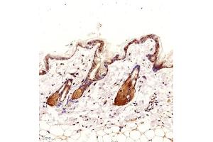 Immunohistochemistry (Paraffin-embedded Sections) (IHC (p)) image for anti-NCK Adaptor Protein 2 (NCK2) antibody (ABIN7074783)