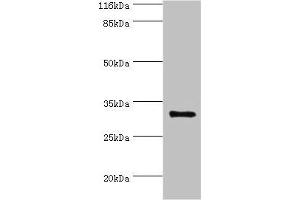 Western blot All lanes: KLK5 antibody at 2 μg/mL + MCF-7 whole cell lysate Secondary Goat polyclonal to rabbit IgG at 1/10000 dilution Predicted band size: 32 kDa Observed band size: 32 kDa (Kallikrein 5 抗体  (AA 23-293))