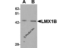 Western Blotting (WB) image for anti-LIM Homeobox Transcription Factor 1, beta (LMX1B) (C-Term) antibody (ABIN1077396) (LMX1B 抗体  (C-Term))