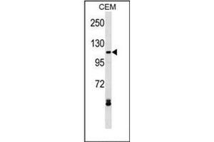 Western blot analysis of EVI1 Antibody (N-term) in CEM cell line lysates (35ug/lane). (MECOM 抗体  (N-Term))