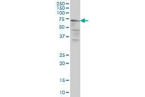 CAPN5 monoclonal antibody (M02A), clone 3C10 Western Blot analysis of CAPN5 expression in HeLa . (Calpain 5 抗体  (AA 523-622))