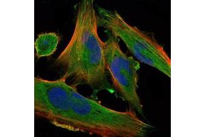 Immunofluorescence analysis of U251 cells using DLK1 mouse mAb (green). (DLK1 抗体)