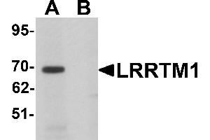 Western Blotting (WB) image for anti-Leucine Rich Repeat Transmembrane Neuronal 1 (LRRTM1) (C-Term) antibody (ABIN1030496) (LRRTM1 抗体  (C-Term))