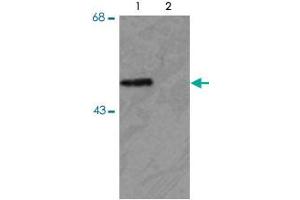 Western blot of HEK293 cells transfected with PARK2 WT (Phospho) and PARK2 S378 mutant (non-phospho) showing the phospho-specific immunolabeling of the ~ 52 k parkin protein. (Parkin 抗体  (pSer378))
