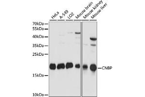 Western blot analysis of extracts of various cell lines, using CNBP antibody (ABIN7266165) at 1:1000 dilution. (CNBP 抗体  (C-Term))
