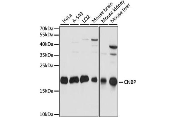 CNBP Antikörper  (C-Term)