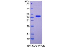 SDS-PAGE (SDS) image for Neutrophil Cytosolic Factor 4, 40kDa (NCF4) (AA 132-339) protein (His tag) (ABIN2126074)