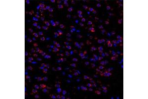Immunofluorescent analysis of paraformaldehyde-fixed rat brain nigra using Torsin A (ABIN7075942) at dilution of 1: 3000 (TOR1A 抗体)