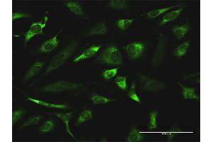 Immunofluorescence of monoclonal antibody to RGN on HeLa cell. (Regucalcin 抗体  (AA 200-299))