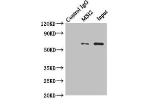 Immunoprecipitating MKS1 in Hela whole cell lysate Lane 1: Rabbit control IgG instead of (1 μg) instead of ABIN7159091 in Hela whole cell lysate. (MKS1 抗体  (AA 150-300))
