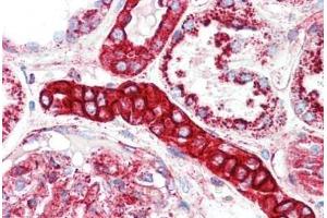 Human Kidney: Formalin-Fixed, Paraffin-Embedded (FFPE) (LAMP1 抗体  (AA 125-154))