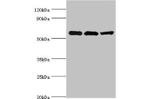 Western blot All lanes: Aldehyde dehydrogenase X, mitochondrial antibody at 4 μg/mL Lane 1: Hela whole cell lysate Lane 2: Rat brain tissue Lane 3: HepG2 whole cell lysate Secondary Goat polyclonal to rabbit IgG at 1/10000 dilution Predicted band size: 57 kDa Observed band size: 57 kDa (ALDH1B1 抗体  (AA 278-517))