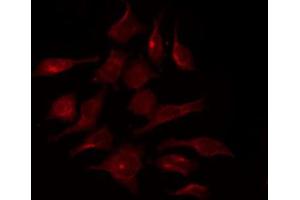 ABIN6267370 staining HepG2 by IF/ICC. (FGFR1 抗体  (pTyr154))