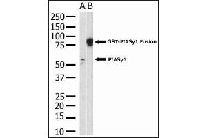 The anti-PIASy polyclonal antibody (ABIN388061 and ABIN2845720) is used in Western blot to detect PIASy in HL-60 cell lysate. (PIAS4 抗体  (N-Term))