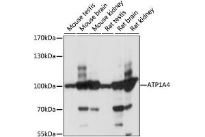 Western blot analysis of extracts of various cell lines, using ATP1A4 antibody (ABIN6292469) at 1:1000 dilution. (ATP1A4 抗体)