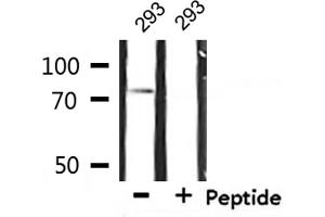 IL2 Receptor beta anticorps  (Internal Region)