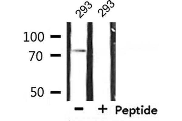 IL2 Receptor beta 抗体  (Internal Region)