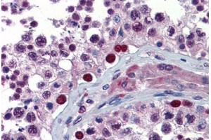 Human Testis (formalin-fixed, paraffin-embedded) stained with NFX1 antibody ABIN462262 followed by biotinylated goat anti-rabbit IgG secondary antibody ABIN481713, alkaline phosphatase-streptavidin and chromogen. (NFX1 抗体  (C-Term))