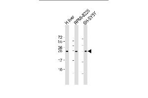 All lanes : Anti-NT5M Antibody (C-Term) at 1:2000 dilution Lane 1: human liver lysate Lane 2: RI-8226 whole cell lysate Lane 3: SH-SY5Y lysate Lysates/proteins at 20 μg per lane. (NT5M 抗体  (AA 195-226))