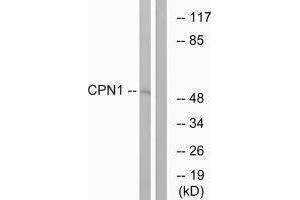 Western blot analysis of extracts from RAW264. (CPN1 抗体  (C-Term))
