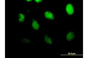Immunofluorescence of purified MaxPab antibody to CSPG6 on HeLa cell.