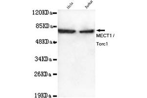 Western blot detection of MECT1 / Torc1 in Hela and Jurkat lysates using MECT1 / Torc1 mouse mAb (1:1000 diluted). (CRTC1 抗体)