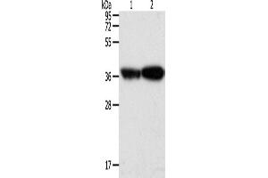 Western Blotting (WB) image for anti-Tropomyosin-2 (TPM2) antibody (ABIN2432365) (TPM2 抗体)