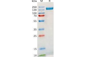 Human TLR3 Protein, hFc Tag on SDS-PAGE under reducing condition. (TLR3 Protein (Fc Tag))