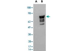 HEK293 overexpressing human PDE4D2 and probed with PDE4D polyclonal antibody  (mock transfection in first lane), tested by Origene. (PDE4D 抗体  (C-Term))