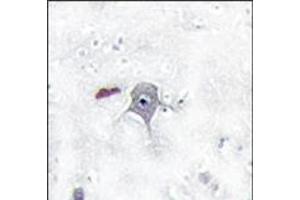 Image no. 1 for anti-Phosphoinositide 3 Kinase, p85 beta (PI3K p85b) (N-Term) antibody (ABIN360465) (PIK3R2 抗体  (N-Term))