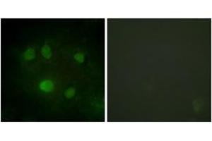 Immunofluorescence (IF) image for anti-DEAD (Asp-Glu-Ala-Asp) Box Polypeptide 5 (DDX5) (AA 565-614) antibody (ABIN2888821) (DDX5 抗体  (AA 565-614))