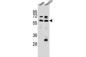 Western Blotting (WB) image for anti-Selenoprotein N, 1 (SEPN1) antibody (ABIN2996755) (SEPN1 抗体)