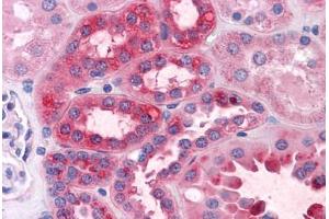 Human Kidney: Formalin-Fixed, Paraffin-Embedded (FFPE) (GPN1 抗体  (AA 9-119))
