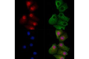 ABIN7094694 and ABIN7098745 staining Hela cells by IF/ICC. (BIN1 抗体  (Internal Region))