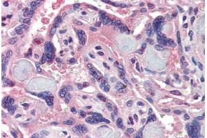 Placenta, Human: Formalin-Fixed, Paraffin-Embedded (FFPE) (NCOA3 抗体  (AA 188-198))