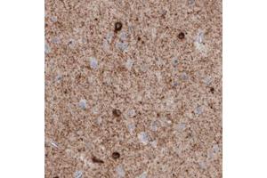 Immunohistochemical staining (Formalin-fixed paraffin-embedded sections) of human cerebral cortex with GAD1 monoclonal antibody, clone CL2911  shows immunoreactivity in neuropil, as well as some neuronal cells bodies. (GAD 抗体)