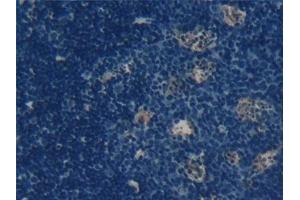 Immunohistochemistry (IHC) image for anti-Tumor Necrosis Factor (Ligand) Superfamily, Member 11 (TNFSF11) (AA 92-263) antibody (ABIN7432754)
