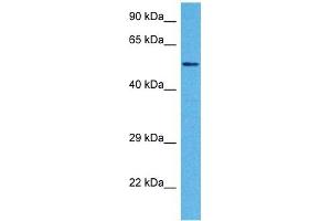 Western Blotting (WB) image for anti-Tripartite Motif Containing 13 (TRIM13) (Middle Region) antibody (ABIN2778286)