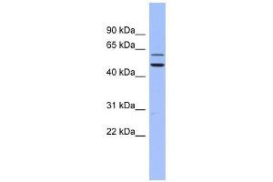 DKC1 antibody used at 1 ug/ml to detect target protein. (DKC1 抗体  (N-Term))