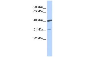 WB Suggested Anti-VSX1 Antibody Titration:  0. (VSX1 抗体  (Middle Region))