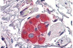 Immunohistochemistry (Formalin-fixed Paraffin-embedded Sections) (IHC (fp)) image for anti-Zinc Finger Protein 36, C3H Type, Homolog (Mouse) (ZFP36) (AA 257-306) antibody (ABIN6747031)
