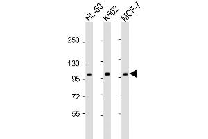 Western Blot at 1:2000 dilution Lane 1: HL-60 whole cell lysate Lane 2: K562 whole cell lysate Lane 3: MCF-7 whole cell lysate Lysates/proteins at 20 ug per lane. (GEN1 抗体  (N-Term))