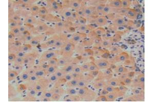 Figure. (SERPINA7 抗体  (AA 128-415))