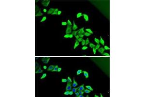 Immunofluorescence analysis of U2OS cells using CDKAL1 Polyclonal Antibody