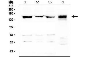 Western blot analysis of LMTK3 using anti-LMTK3 antibody (ABIN6719386).