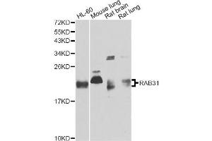 Western blot analysis of extracts of various cell lines, using RAB31 antibody (ABIN5995563) at 1/1000 dilution. (RAB31 抗体)