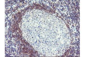 Immunohistochemical staining of paraffin-embedded Human tonsil using anti-PLDN mouse monoclonal antibody. (Pallidin 抗体)