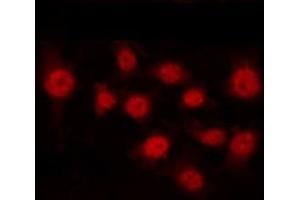 Immunofluorescence (fixed cells) (IF/ICC) image for anti-CCAAT/enhancer Binding Protein (C/EBP), beta (CEBPB) (pThr235) antibody (ABIN6256518)
