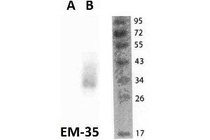 Western blotting analysis of FOLR2 in THP1 cells (A) and FOLR2-transfected THP1 cells (B) using anti-FOLR2 (EM-35) purified. (FOLR2 抗体)